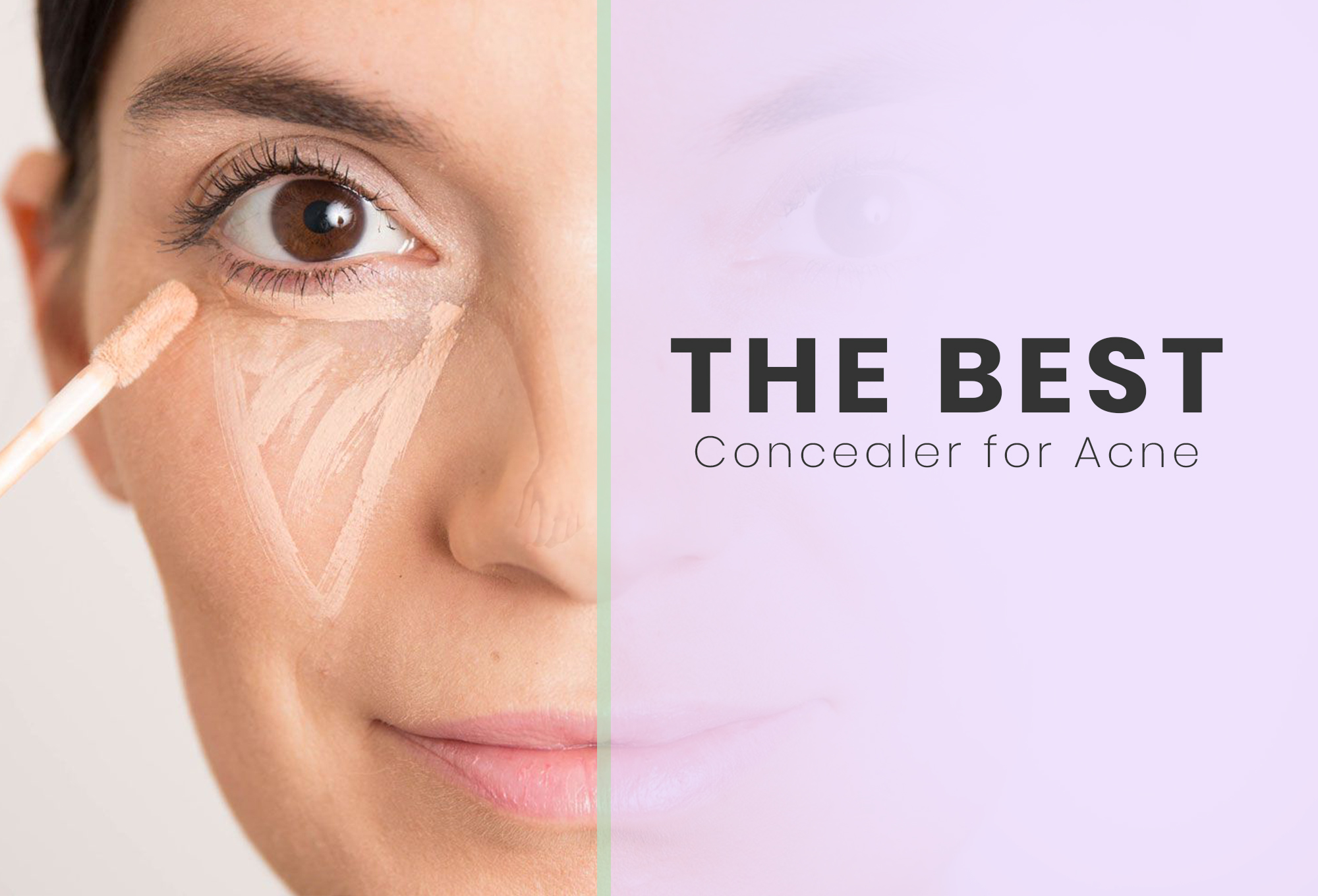 foundation or concealer first for acne